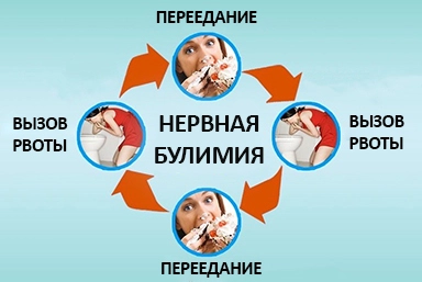Лечение булимии в Камышине